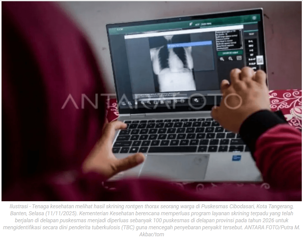 Dinkes Kota Madiun tingkatkan deteksi kasus baru penyakit TBC